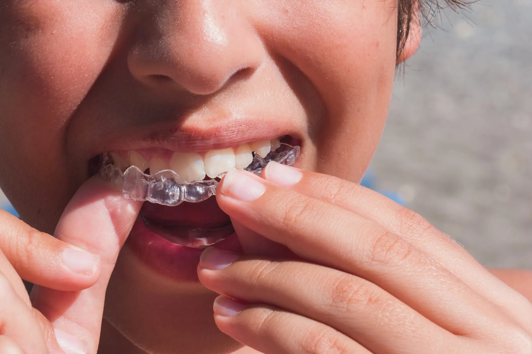 Orthodontics